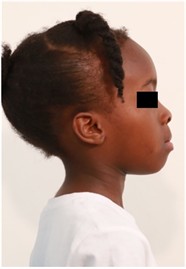 Sibling 1’s initial facial pictures