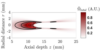 Two-dimensional axisymmetric acoustic field shielding effect and spatial distortion reconstruction of “tadpole-shaped” composite damage