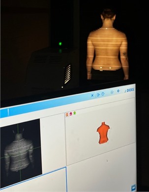 Posture assessment using the Diers Formetric 4D system