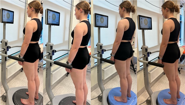 Static balance testing under four conditions with the Modified Clinical Test of Sensory Integration and Balance on the Biodex Balance System, version 4.x